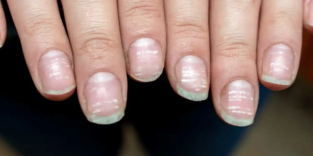 staleks posuda za sterilizator